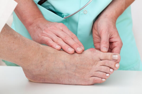 best inserts for bunions