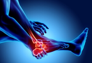 What Is Juvenile Idiopathic Arthritis?